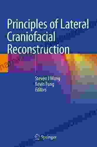 Principles of Lateral Craniofacial Reconstruction