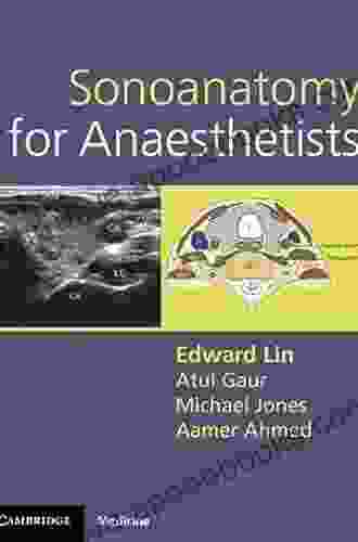 Sonoanatomy For Anaesthetists (Cambridge Medicine (Paperback))