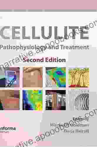 Cellulite: Pathophysiology And Treatment (Basic And Clinical Dermatology 1)